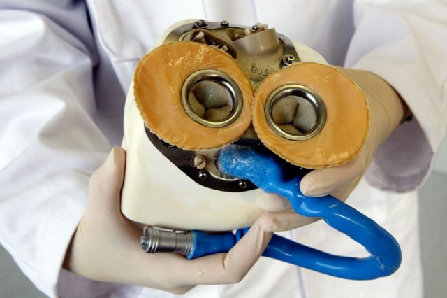 Прототип повністю імплантованого всередину штучного серця, створений французькими дослідниками, 27 жовтня 2008 року